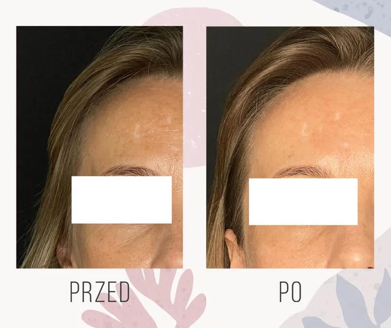 Chemiczne środki do usuwania plam