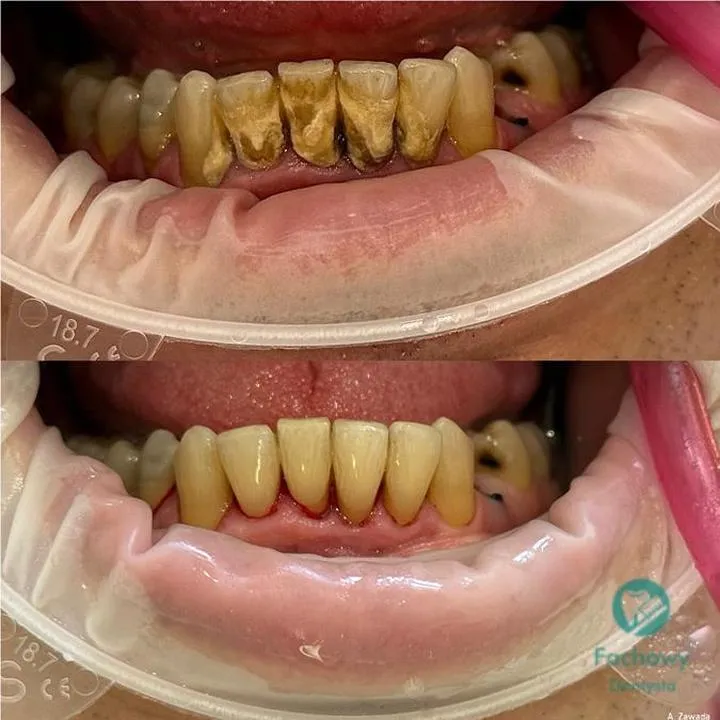 Naturalne środki czyszczące do kamienia